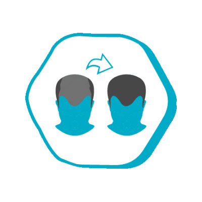 j4 j4 Postoperativ hårvask Istanbul Hair NO Prices in Turkey