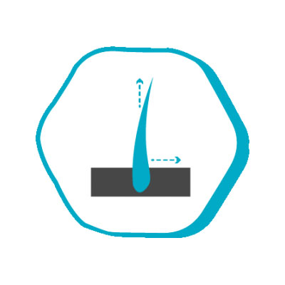 j7 j7 Etter hårtransplantasjonsoperasjon Istanbul Hair NO Prices in Turkey