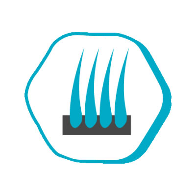 j8 j8 Etter hårtransplantasjonsoperasjon Istanbul Hair NO Prices in Turkey